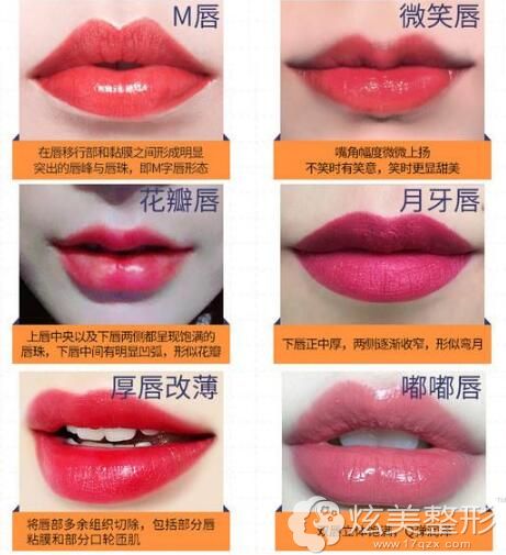 常见的唇部整形项目