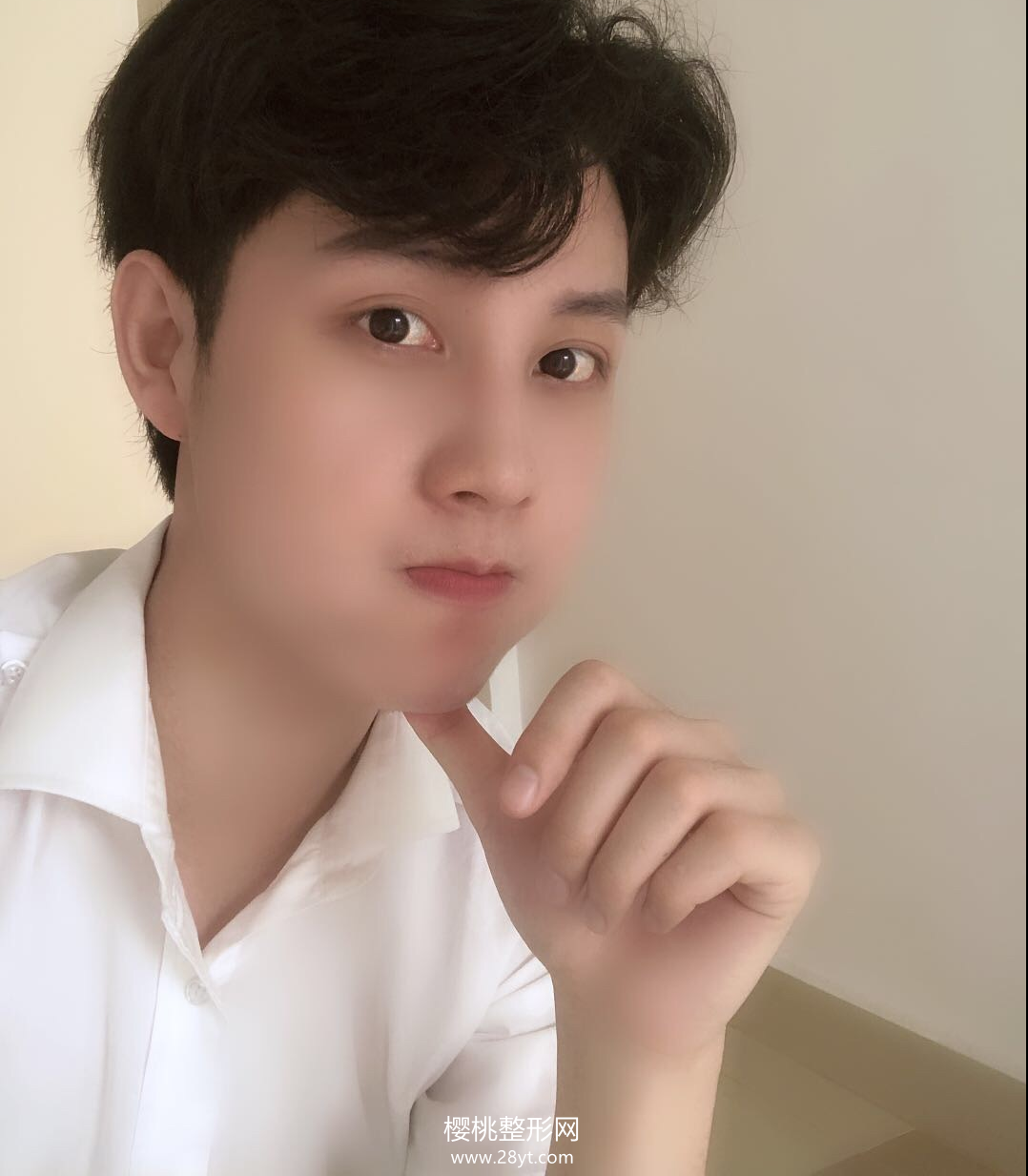 武汉欧尚美王大山隆鼻技术如何?附真人案例+最新价格表一览