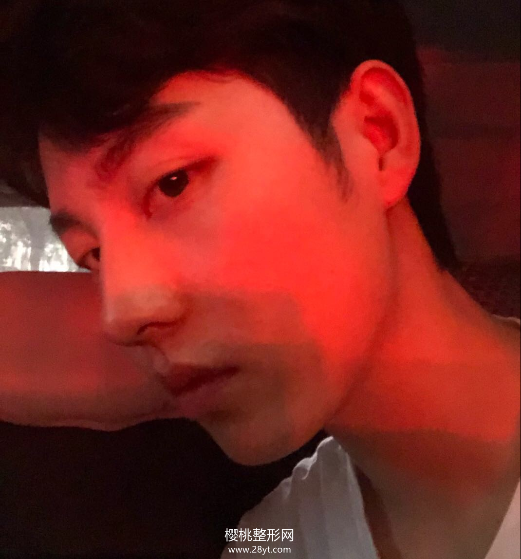 武汉欧尚美王大山隆鼻技术如何?附真人案例+最新价格表一览