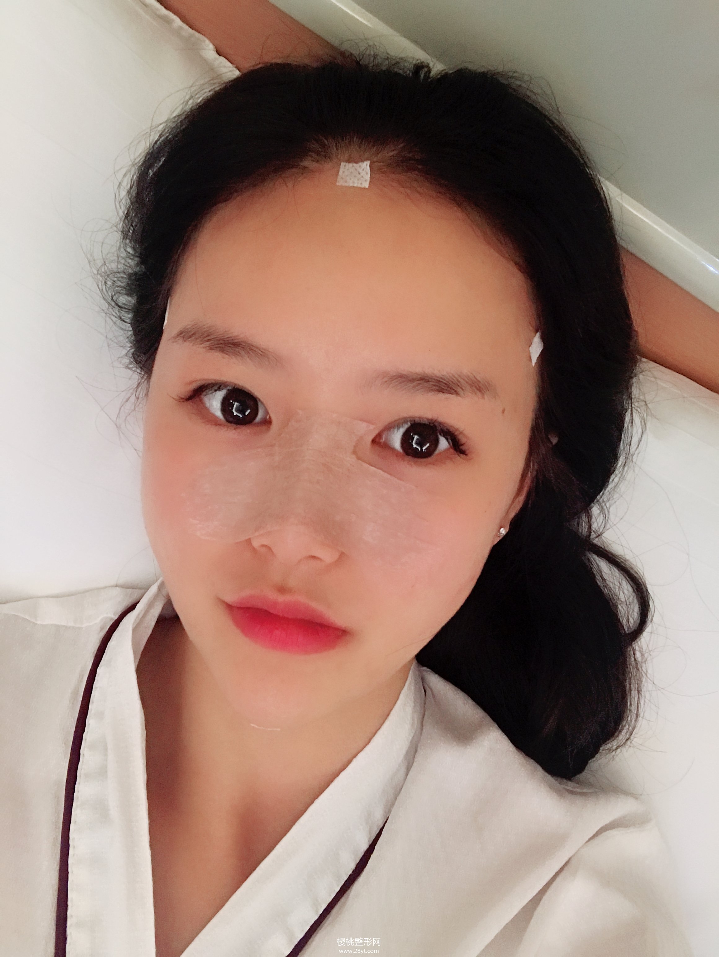 武汉伽美付毅做鼻子效果好不好?价格贵不贵?有真人案例参考吗?