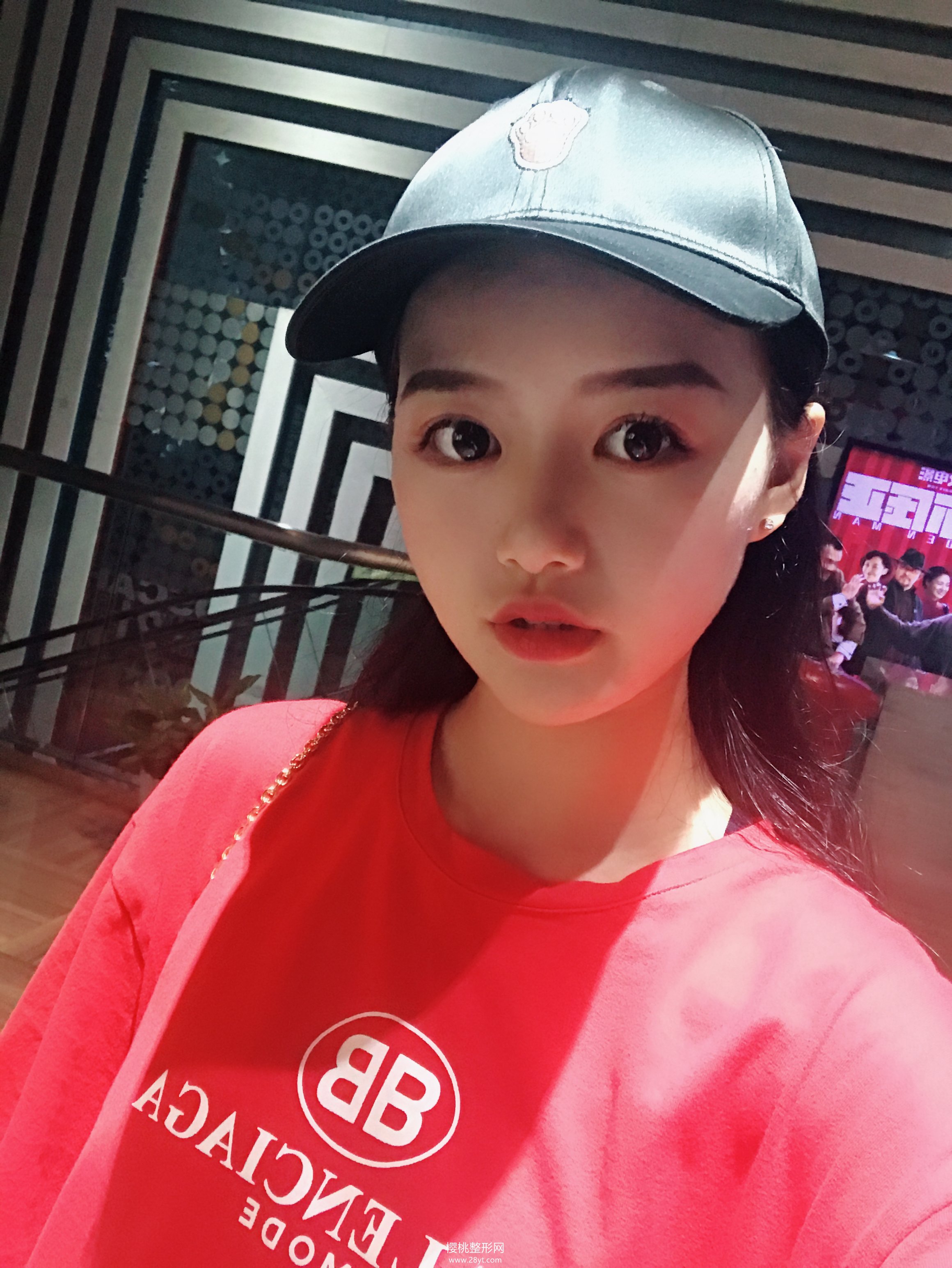 武汉伽美付毅做鼻子效果好不好?价格贵不贵?有真人案例参考吗?