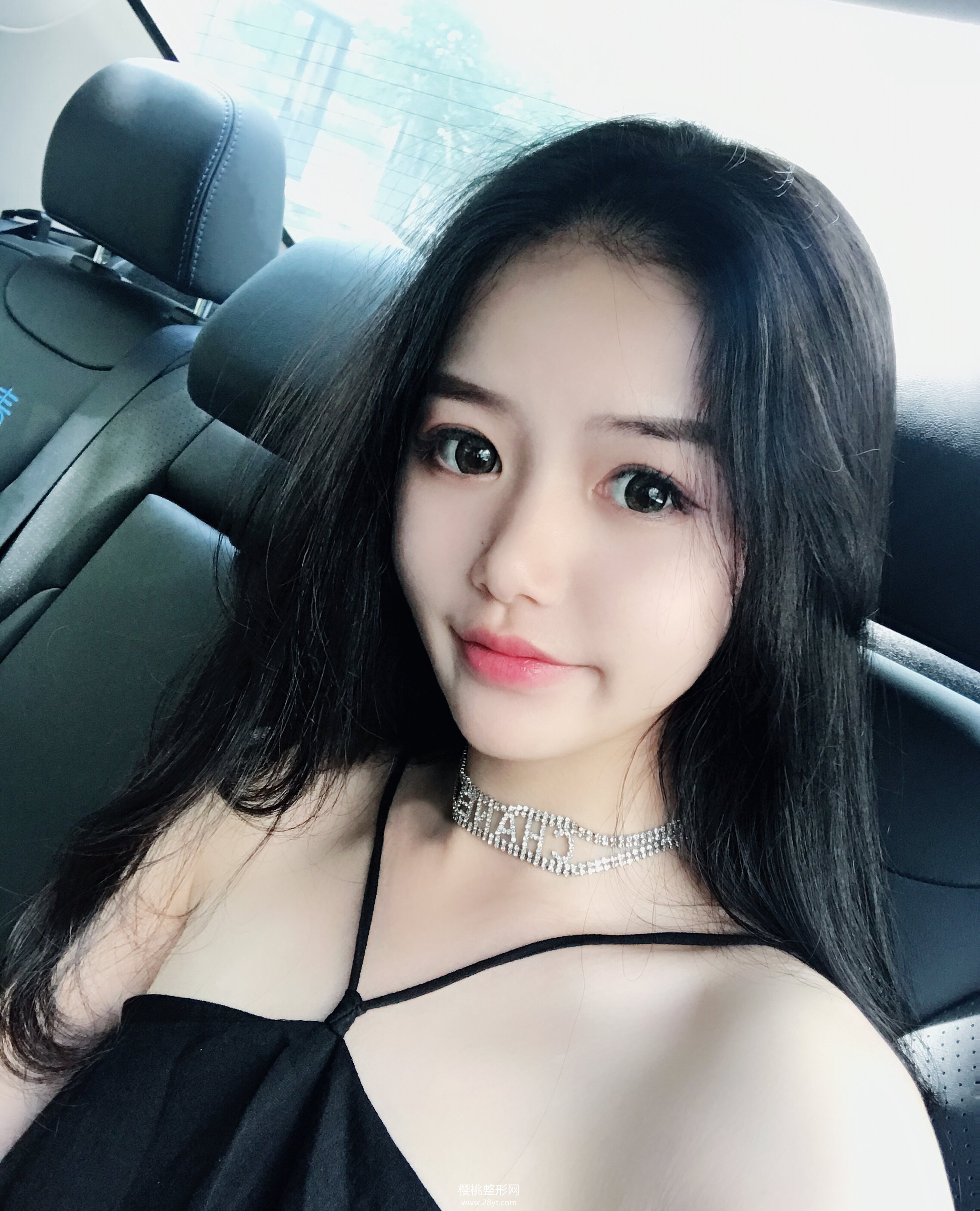 武汉伽美付毅做鼻子效果好不好?价格贵不贵?有真人案例参考吗?