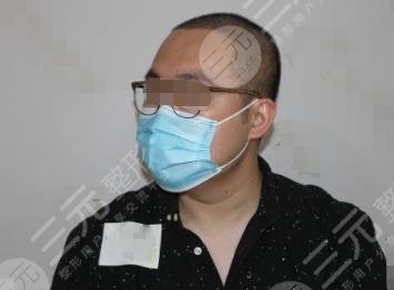 上海华美植发中心头发种植案例分享