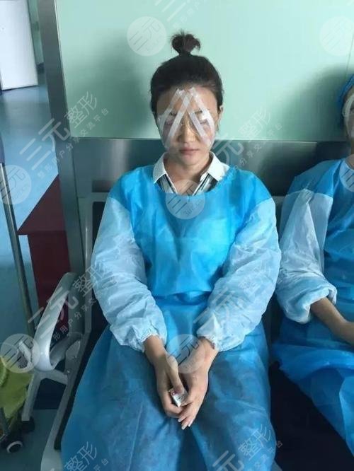 北京协和眼科近视矫正案例分享：术后当天