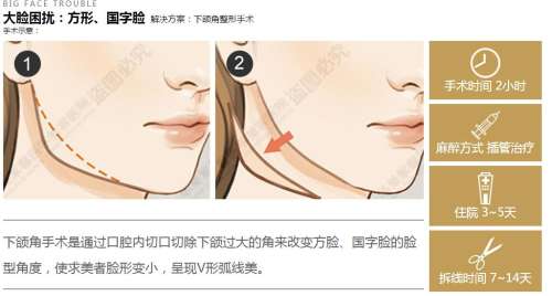 八大处和九院削骨哪个好.jpg 八大处和九院削骨哪个好.jpg