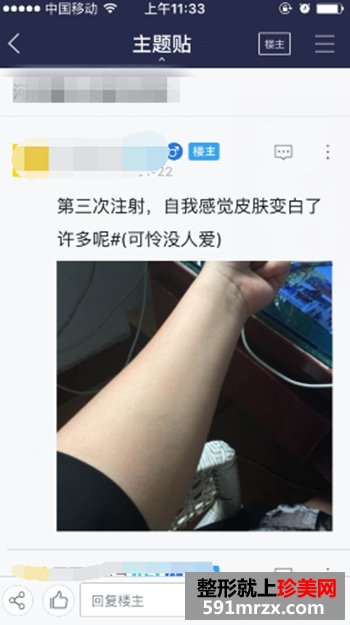 注射美白针五次了 美白的效果越来越明显