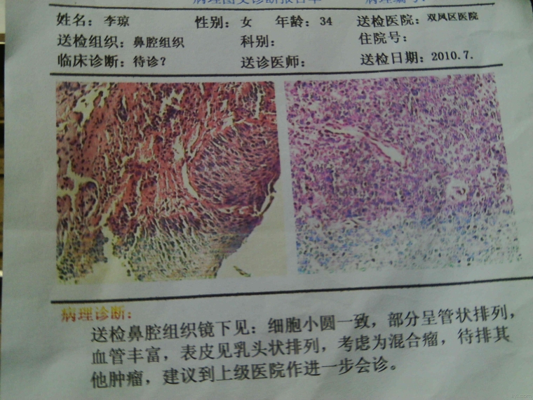 点斑需要多少钱？