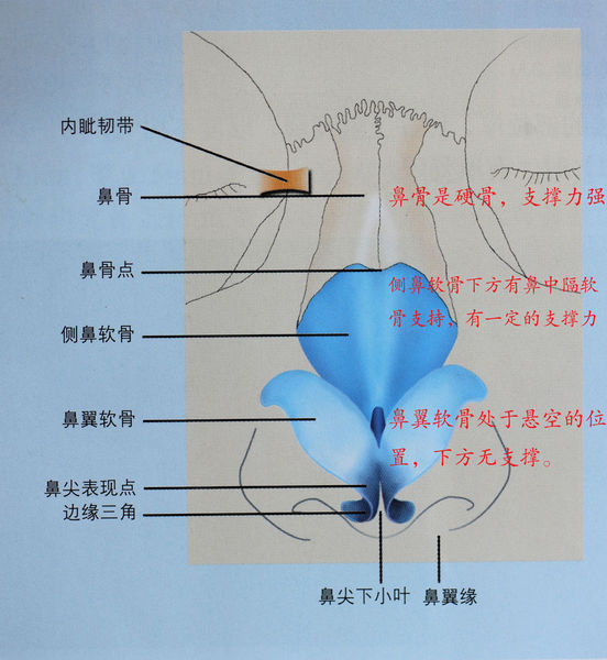 隆鼻后不能揉来揉去?