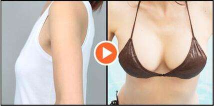 隆胸矫正乳房下垂的*果好不好?