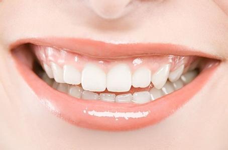 怎样才能长期美白四环素牙齿?