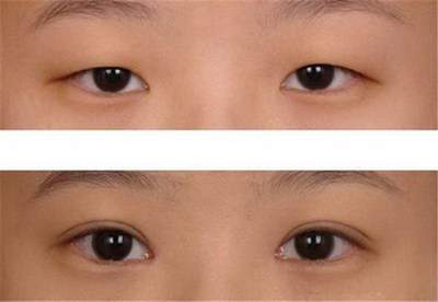 半永久野生眉 项目分类：半永久 半永久纹眉