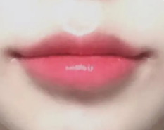 汉中韩美整形美容医院的M唇整形真实案例，手术前后对比分享