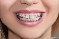 关于一些牙齿不齐原因，有哪些矫正方法