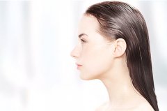 女性种植的毛发好吗？效果怎么样？有危害吗？