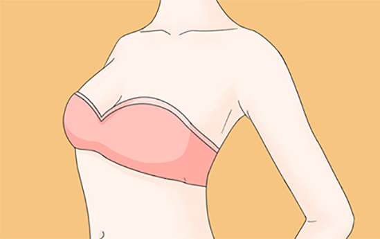 假体隆胸效果怎么样？假体隆胸有哪些优点？