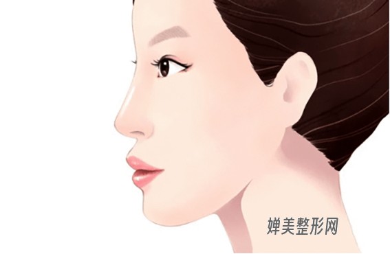 假体隆鼻方法有哪些？假体隆鼻有哪些优点？