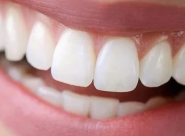 地包天牙齿能预防吗 乌鲁木齐凯乐地包天矫正有哪些方式