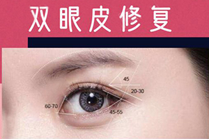 北京双眼皮修复那个专家好 美莱杜圆圆 眼部修复金手指美誉