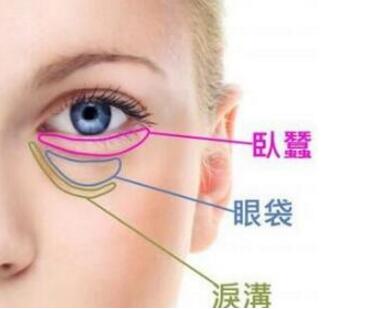 祛眼袋手术方法都有哪些 广州时光医院激光去眼袋价格多少