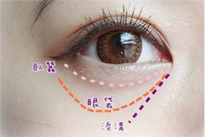 南京哪个医院祛眼袋好 激光去眼袋的价格是多少