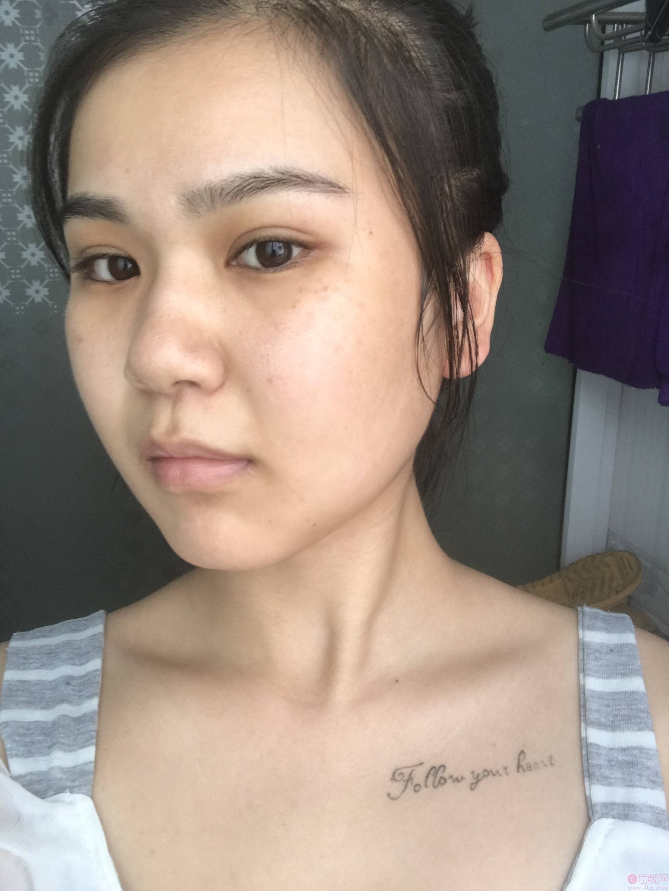 广州曙光美容医院祛斑怎么样?附祛斑前后效果对比及2021项目价格表发布