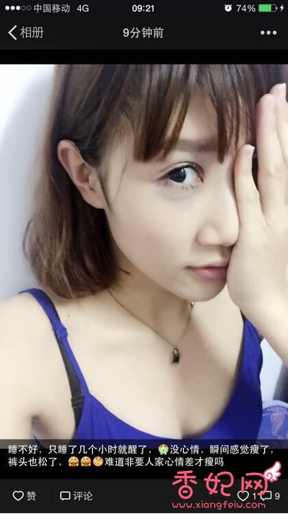 韩式三点整形案例分享重庆哪家医院做双眼皮手术好