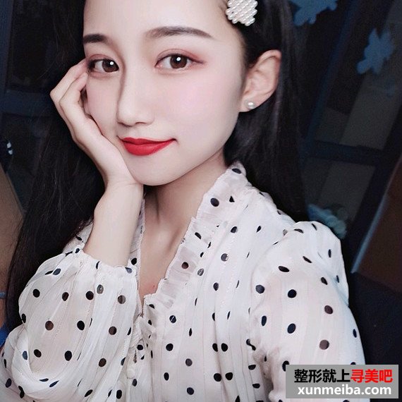长沙美容院自体脂肪面部填充和假体丰下巴整形日记 长沙美容院自体脂肪面部填充和假体丰下巴整形日记