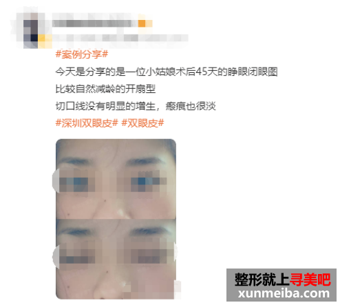 1656140615116056.png image.png