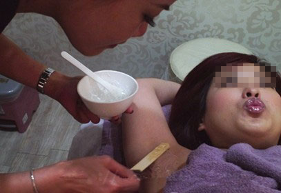 激光脱腋毛