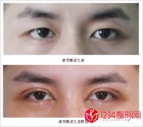 男士双眼皮有几种款式类型哪种好看(图片)